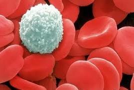 Leucemia