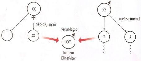 Causa da Síndrome de Klinefelter
