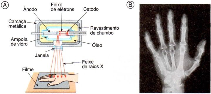 Equipamento de raios X.