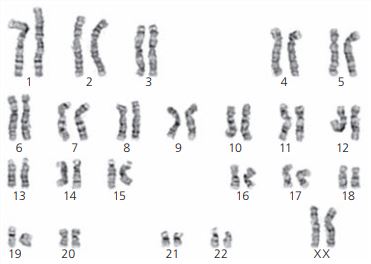 Cariótipo masculino.