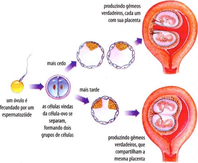 Como ocorre a gravidez de gêmeos verdadeiros