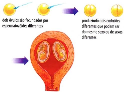 Como ocorre a gravidez de gêmeos falsos