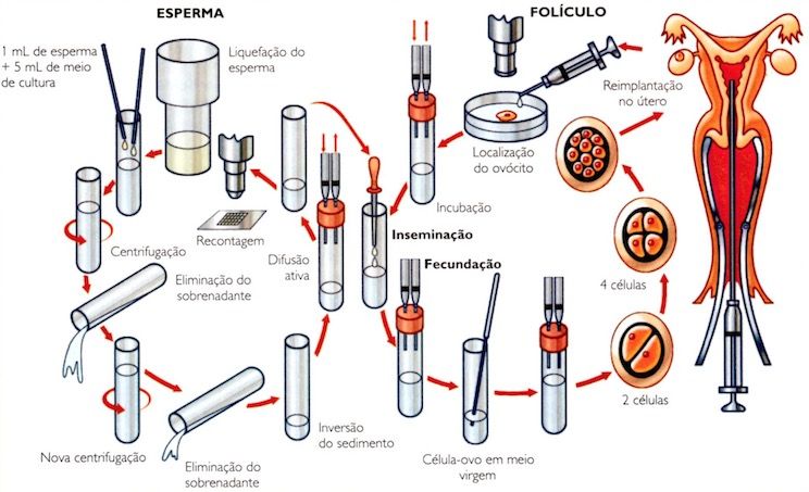 Etapas da fertilização in vitro.