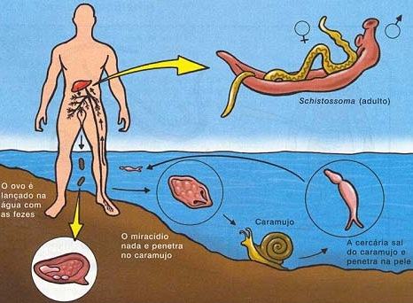 Contaminação pela esquistossomose.