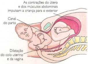 Ilustração do parto de um bebê