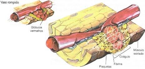 Plaquetas