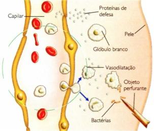 Reação inflamatória do sistema imunológico.